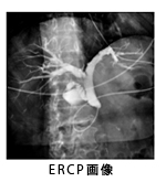ERCP画像